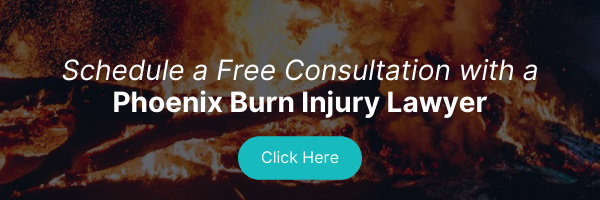 schedule a free consultation with a phoenix burn injury lawyer